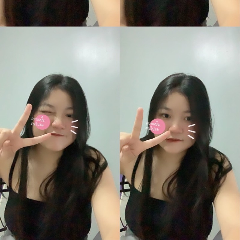 เฟิส