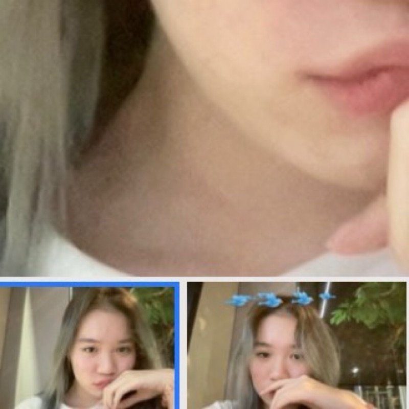 วิว