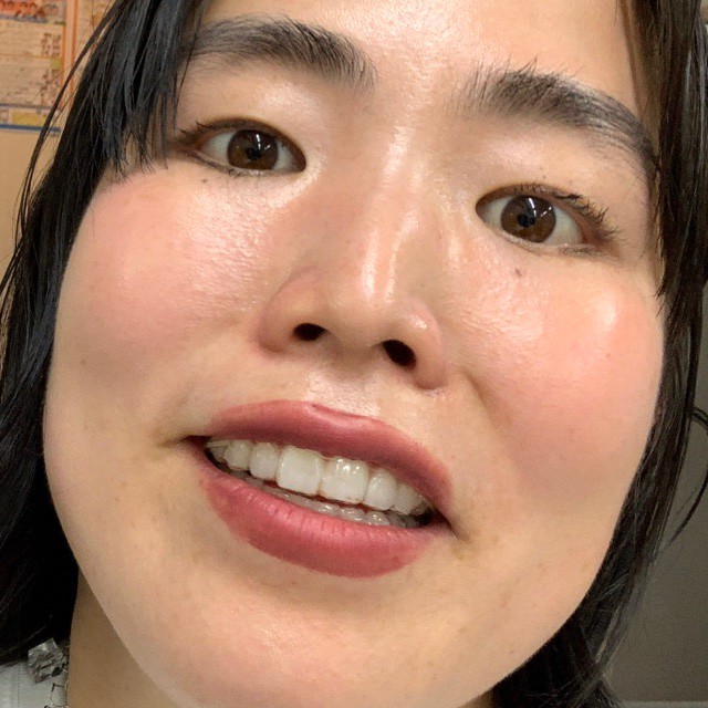 ゆりやんレトリィバァ